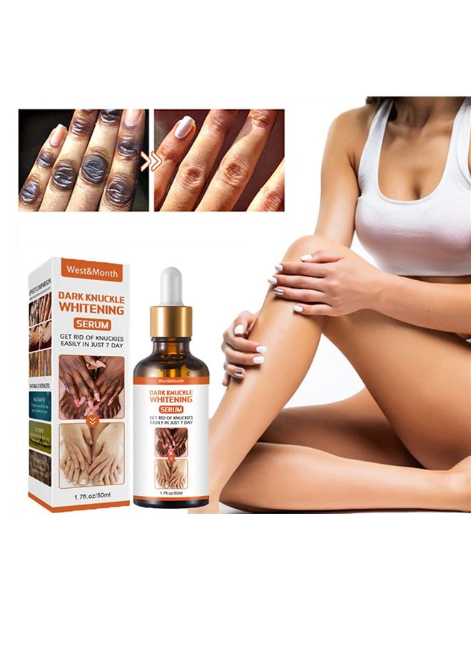 West&Month Dark Knuckle Whitening Serum - Restoring Hand Treatment, Moisturizing, Exfoliates and Reduces Unbalanced Pigmentation, for Removing Dark Knuckle Elbow, Brighter, Firmer Skin  - Image 1