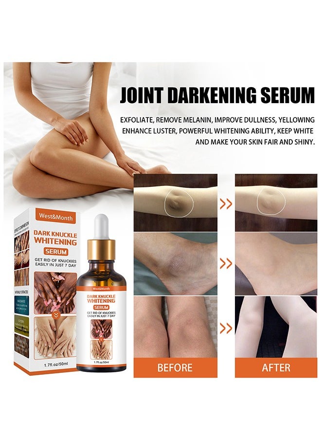 West&Month Dark Knuckle Whitening Serum - Restoring Hand Treatment, Moisturizing, Exfoliates and Reduces Unbalanced Pigmentation, for Removing Dark Knuckle Elbow, Brighter, Firmer Skin  - Image 4