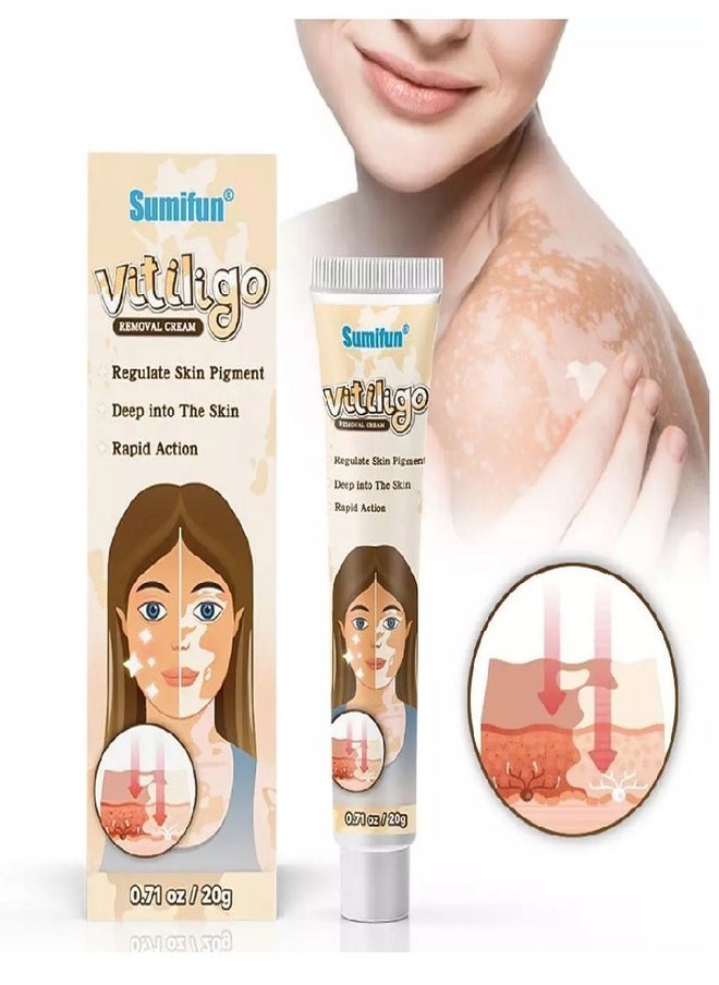 Vitiligo Skin Care Cream, Reduce White Spots, Vitiligo Cream, Improve Skin Pigmentation (1pc) - pzsku/ZD0D2C7CD3AC7A66229B5Z/45/_/1723021491/507487d0-19df-42ae-93d9-a9935cb1b262