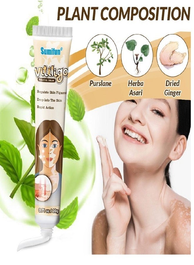 Vitiligo Skin Care Cream, Reduce White Spots, Vitiligo Cream, Improve Skin Pigmentation (1pc) - pzsku/ZD0D2C7CD3AC7A66229B5Z/45/_/1723021495/f75f1ed2-631c-4edd-a56d-e051a238119f