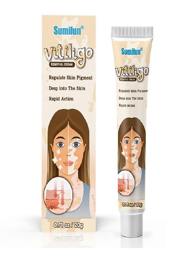 Vitiligo Skin Care Cream, Reduce White Spots, Vitiligo Cream, Improve Skin Pigmentation (1pc) - pzsku/ZD0D2C7CD3AC7A66229B5Z/45/_/1723021504/1b5d181d-da3c-4404-ac7a-711218853840