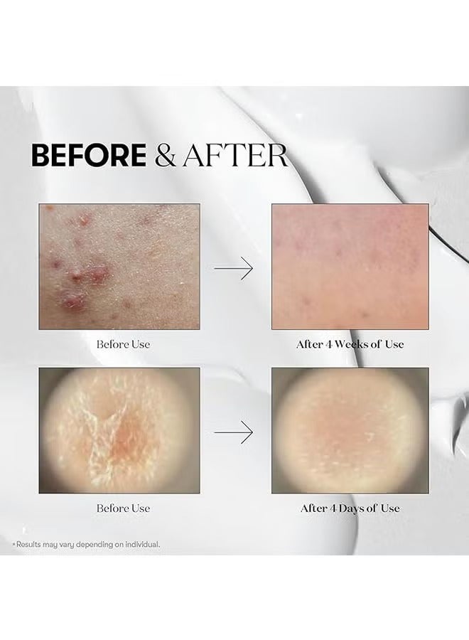 VT COSMETICS CICA Mild Reedle Shot 50 - 50ml - Image 3