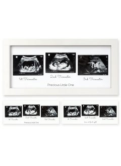 Sonogram Picture Frame Trio Ultrasound Picture Frames For Mom To Be Gift Baby Ultrasound Frame For Pregnancy Announcements Baby Nursery Decor Pregnant Mom Gifts (Alpine White)