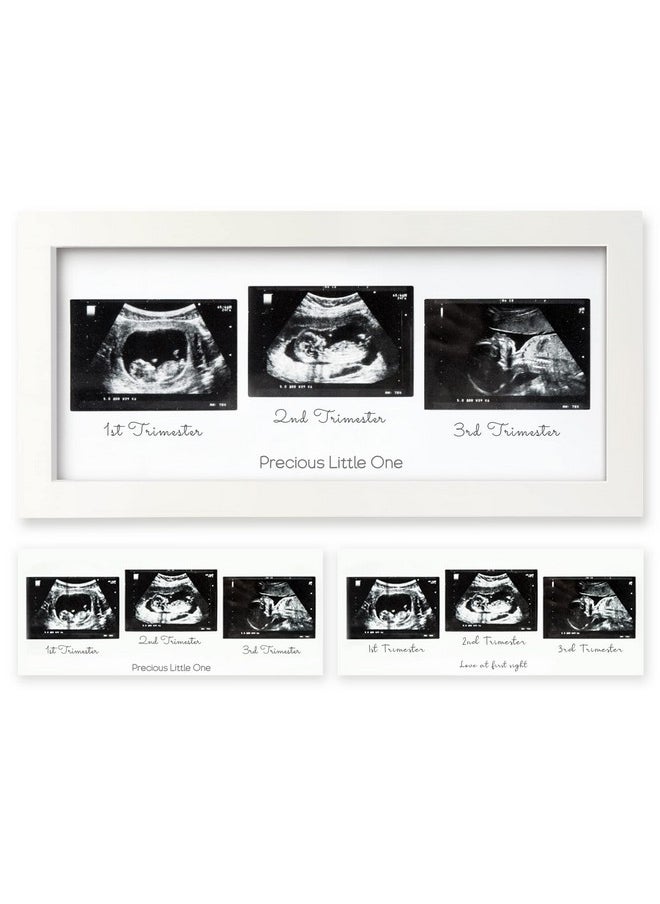 KeaBabies - Sonogram Picture Frame Trio Ultrasound Picture Frames For Mom To Be Gift Baby Ultrasound Frame For Pregnancy Announcements Baby Nursery Decor Pregnant Mom Gifts (Alpine White) - Image 1