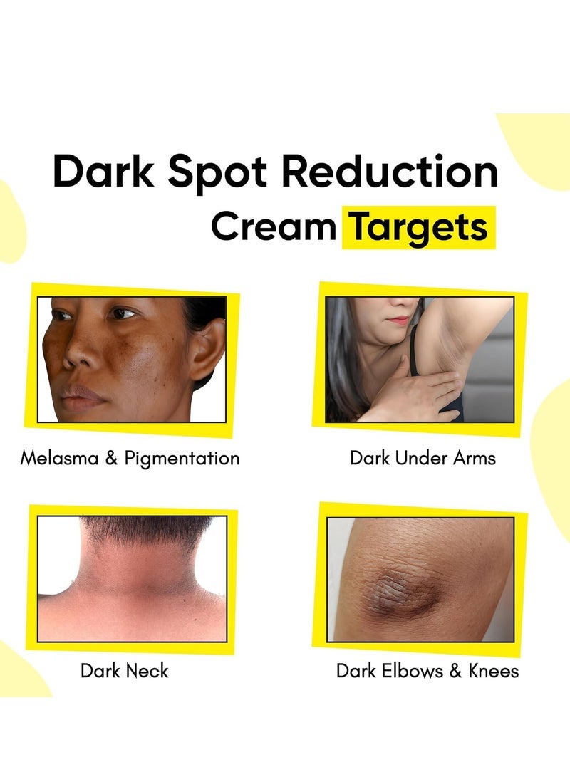 Masofta Dark Spot Reduction & Removal Cream for Pigmentation, Melasma, Acne Marks, Blemishes, Underarms, Neck, Knees & Knuckles | Dark Spot & Patch Corrector | with Kojic Acid, Alpha Arbutin & Niacinamide | For Men & Women | 50g - Image 2