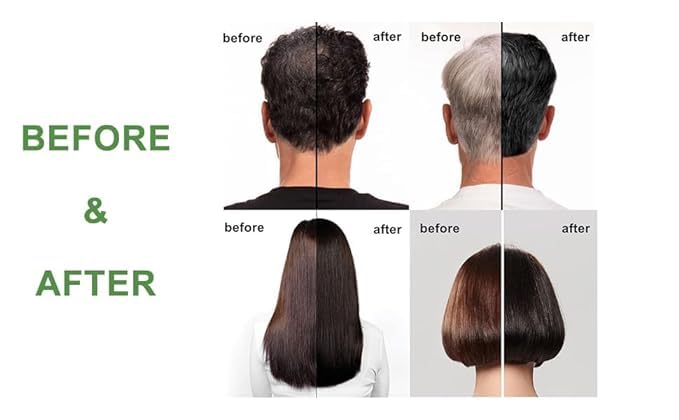 SKINPLUS Fruit Vinegar Gel Hair Color Natural Black Color Dye for Men Women Ammonia Free 250ml x 2 - Image 5