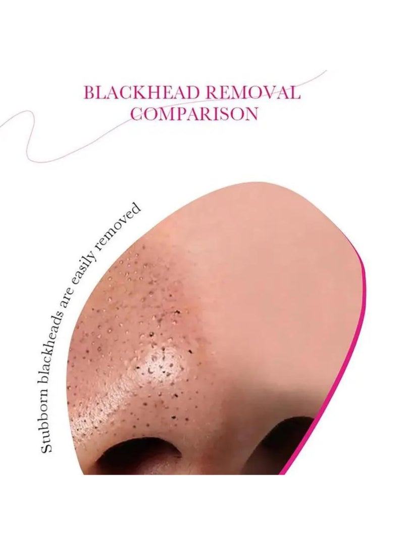 SADOER - Charcoal deep cleansing nose strips - Image 1