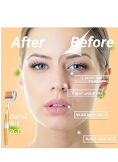 ZGTS Zgts Micro Needle Derma Roller 0.75mm  - Image 5