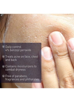 abreva Panoxyl 4% Benzoyl Peroxide Creamy Acne Wash 6 Ounce (Value Pack Of 5)  - Image 2
