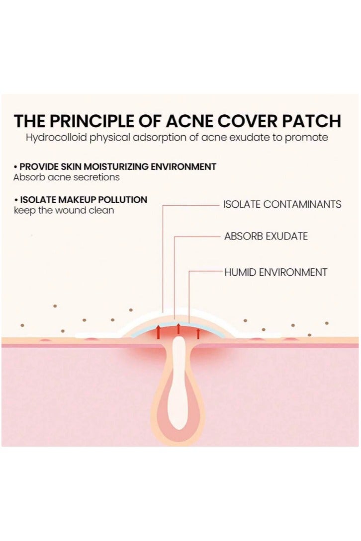 KHAJUL 200 Count Pimple Patch, Acne Covering Stickers for Face and Skin, For Men and Women Daily Skin Care - Image 4