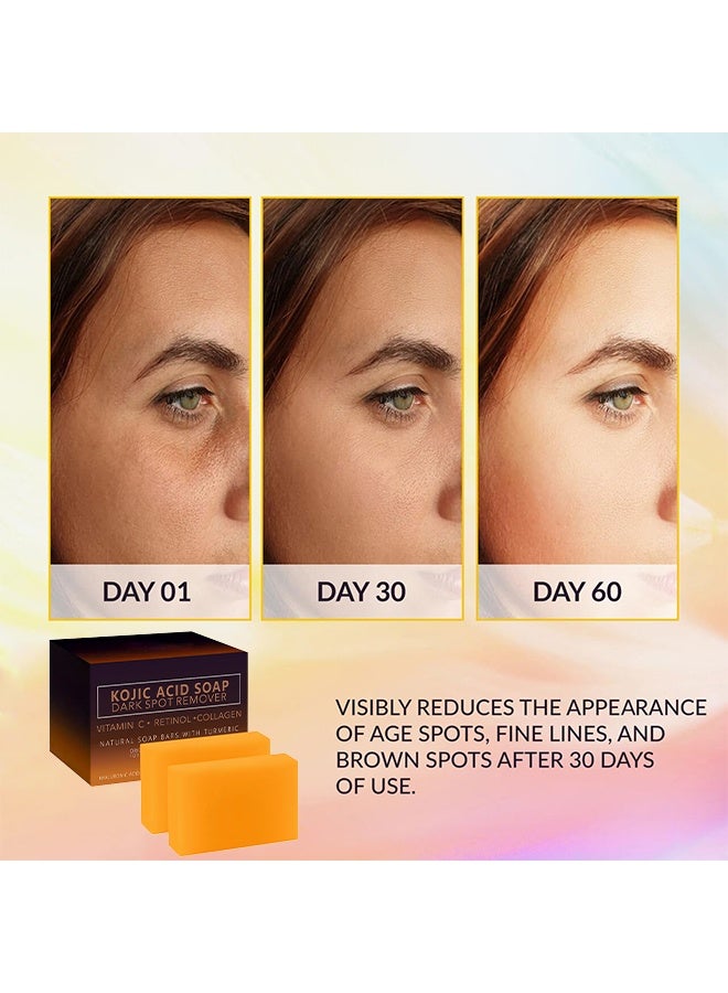 Kojic Acid Soap Dark Spot Remover, Natural Turmeric Soap Bars with Vitamin C, Retinol, Collagen for Hyperpigmentation - Original Japanese Complex Infused with Hyaluronic Acid, Vitamin E, Shea Butter and Castile Olive Oil for Even and Brighter Skin Tone, Face & Body (2 Pack) - Image 5