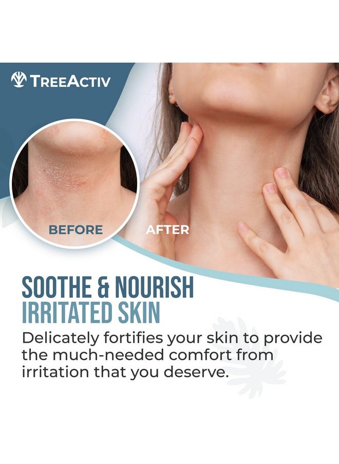 TreeActiv - Seborrheic Dermatitis Cream 8Oz Psoriasis Cream For Face And Body Hydrating Seborrheic Dermatitis Treatment Eczema Psoriasis Cream For Scalp Dry Skin Lotion And Body Cream 500+ Uses - Image 1