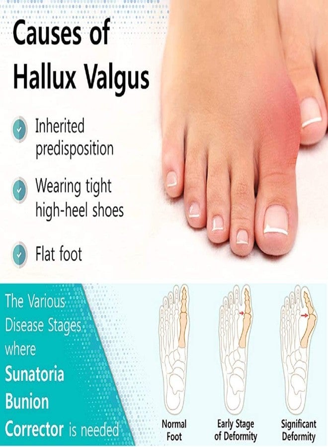 Dingger Toe Separator for Feet Toe Spacers Correct Toes Yoga Silicone Hammer Toe Corrector for Women & Men Correct Toe Straighteners for Overlapping Toes (All Finger Toe Separator) - Image 3