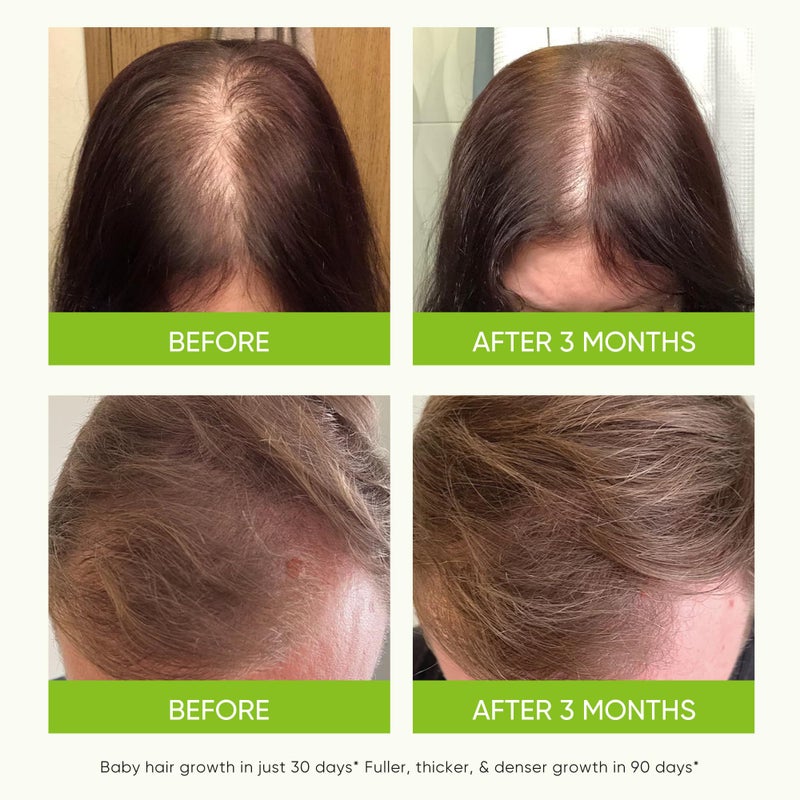 Svvimer Hair Growth Serum Spray - with Rosemary Batana Oil Biotin for Hair Loss and Thinning Hair - Thicker Fuller Hair for Women Men 2 Fl Oz (Pack of 1) - Image 4