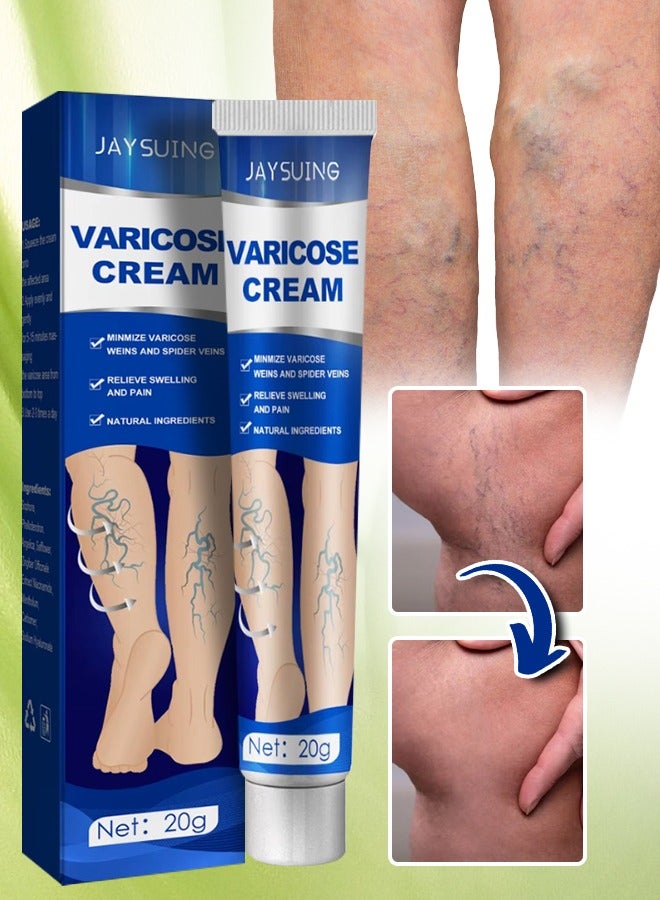 Jaysuing Varicose Cream Improve Spider Veins Varicose Veins Cream Relieve Swelling Varicose Vein Removal Ointment Eliminate Appearance of Varicose Veins Vein Inflammation Treatment 20g  - Image 1