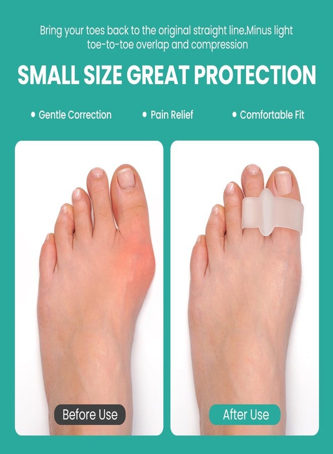 Welnove 12 Pack Gel Bunion Corrector with Aloe Extract Toe Separators for Bunion Correction and Restore Original Shape of Toe for Women and Men - Image 4