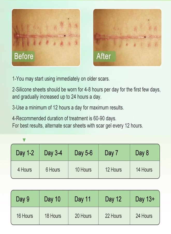 ZODENIS Silicone Scar Sheets(1.6” x 60”Inch- 1.5M), Scar Tape, Scar Strips, Medical Grade, Scar Remover, C-Section, Surgery, Keloid, Tummy Tuck, Scar Patch. - Image 3