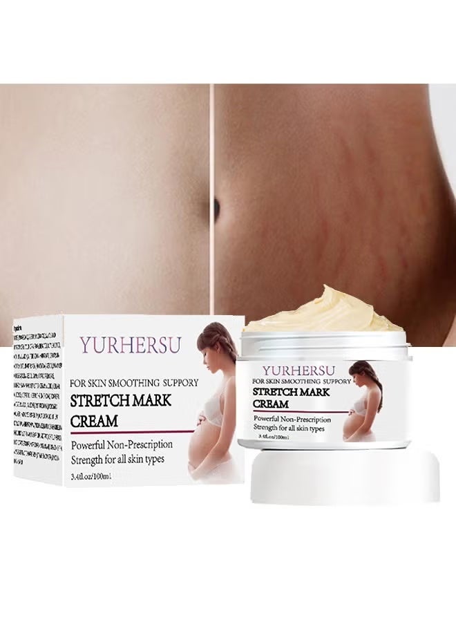 YURHERSU كريم علامات التمدد، كريم منع علامات التمدد أثناء الحمل، كريم إزالة علامات التمدد، كريم علامات التمدد للتدليك أثناء الحمل، يقلل من مظهر الندوب، العناية ببشرة البطن أثناء الحمل وبعده 100 مل - Image 1