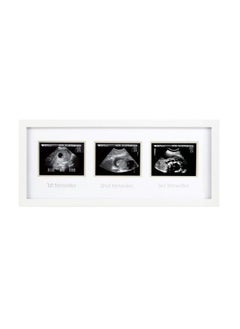 pearhead Sonogram Progression Frame - Trimester by Trimester Pregnancy Milestone Keepsake, Gender-Neutral Nursery Decor, Displays 1st, 2nd & 3rd Trimester Ultrasound Photos, White  - Image 1