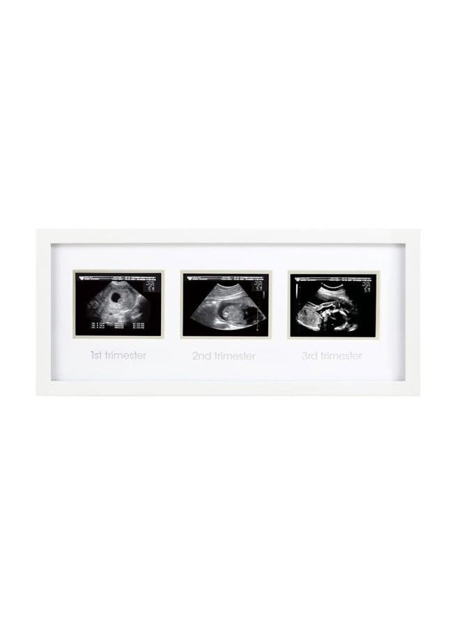 pearhead Sonogram Progression Frame - Trimester by Trimester Pregnancy Milestone Keepsake, Gender-Neutral Nursery Decor, Displays 1st, 2nd & 3rd Trimester Ultrasound Photos, White  - Image 1