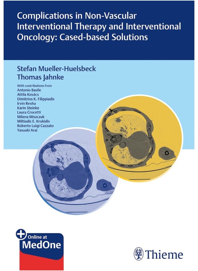 Complications in Non-Vascular Interventional Thera 