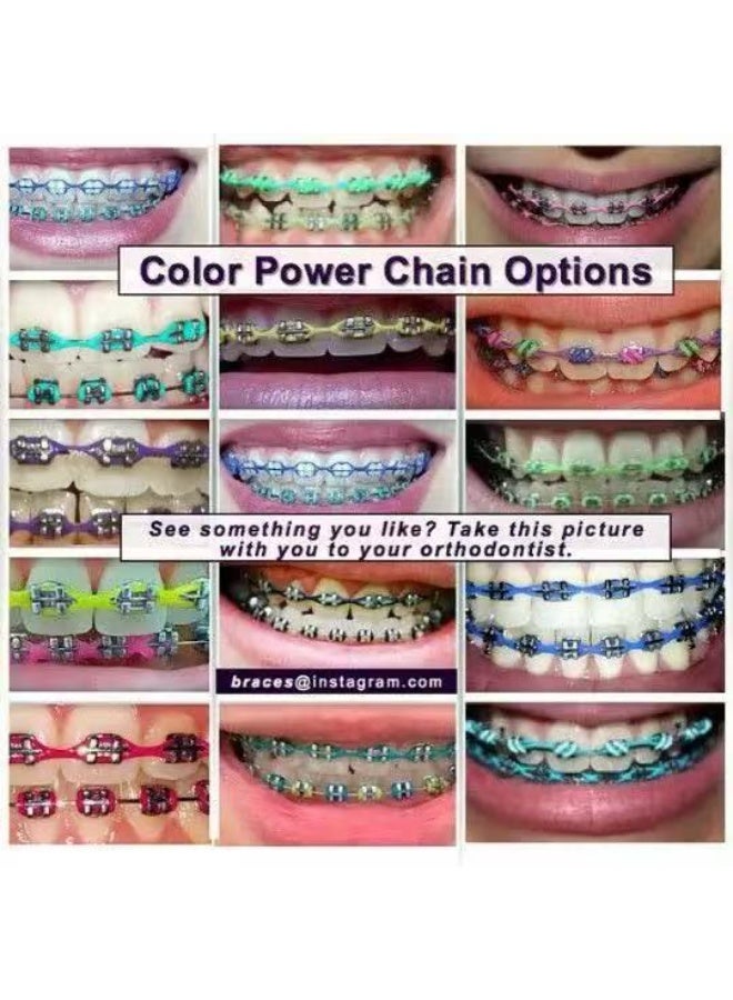 4.57M Orthodontic Rubber Chain, Braces Dynamic Chain (4.0mm) - Image 2