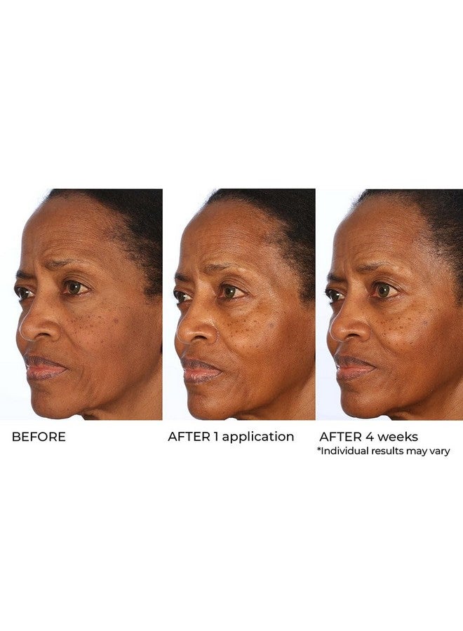 nassif md Nassifmd® Radiance Booster Vitamins C For Face Brightening Serum Dark Spot Remover Vitamin C With Omega3 And Squalene Oil - Image 5