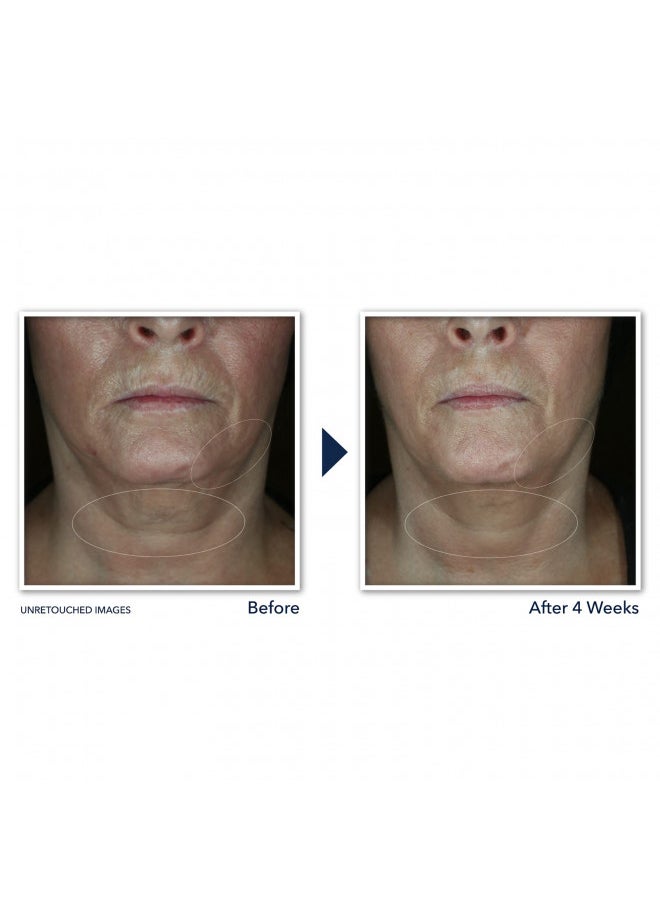 RoC - RoC Derm Correxion Neck Cream with Hyaluronic Acid and Advanced Retinol to visibly Tighten & Lift Horizontal Neck Lines, Facial Moisturiser to Contour Face, Neck and Jawline, 1.7oz - Image 1