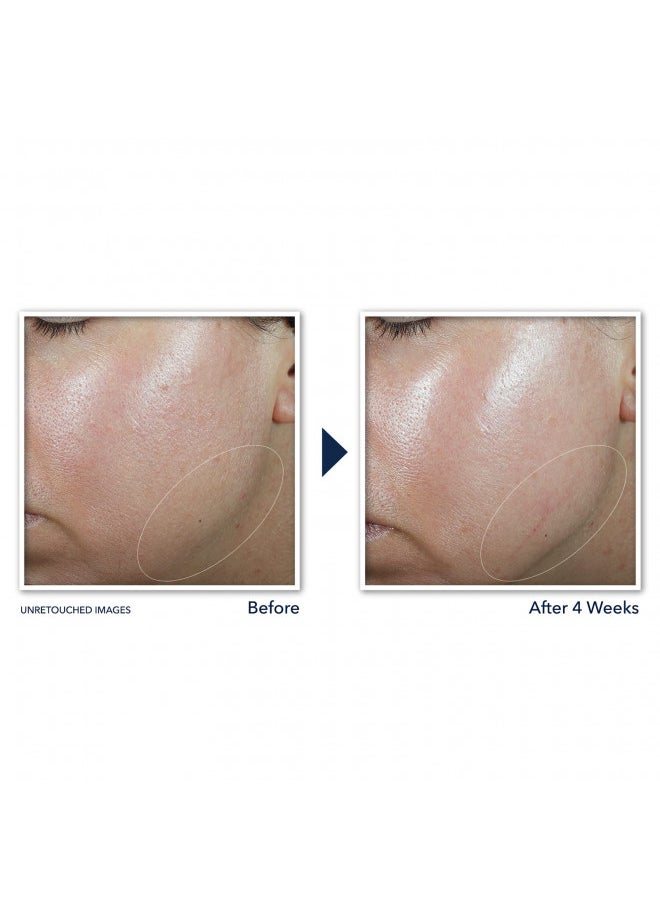 RoC - RoC Derm Correxion Neck Cream with Hyaluronic Acid and Advanced Retinol to visibly Tighten & Lift Horizontal Neck Lines, Facial Moisturiser to Contour Face, Neck and Jawline, 1.7oz - Image 1