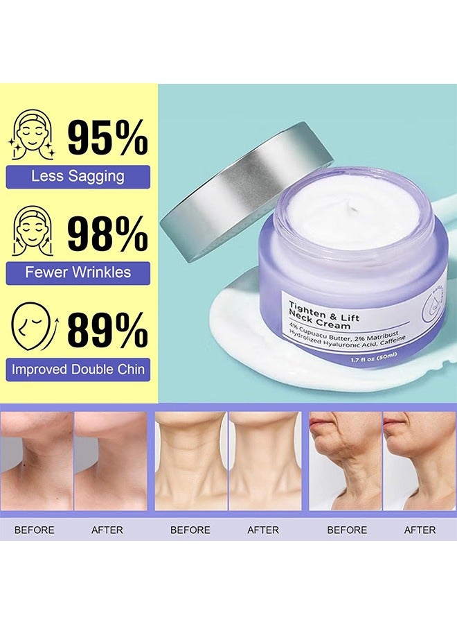 LIFT Neck Firming Cream Tightening Lifting Sagging Skin, Tighten And Lift Neck Cream, Tighten And Lift Firming For Crepey Skin (1PCS) - Image 5