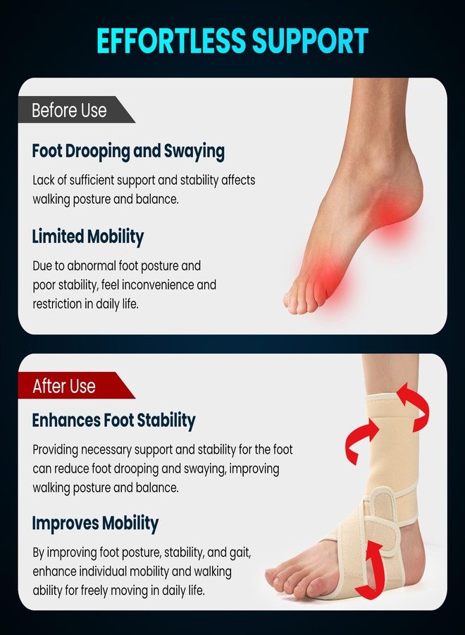 Welnove Drop Foot Brace with Arch Support, AFO Ankle Brace for Walking, Relieves Instability of Lower Limbs by Foot Drop, MS, TBI, Spinal Cord Injury, Cerebral Palsy (Left, Beige) - Image 3