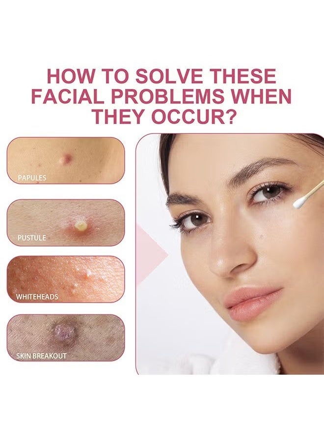 باروبت غسول تجفيف حب الشباب بحمض الساليسيليك بحجم 40 مل - إصلاح حب الشباب، يعزز إزالة حب الشباب، مناسب لجميع أنواع البشرة - Image 4