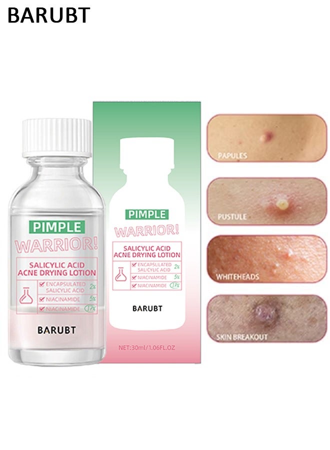 باروبت غسول تجفيف حب الشباب بحمض الساليسيليك بحجم 40 مل - إصلاح حب الشباب، يعزز إزالة حب الشباب، مناسب لجميع أنواع البشرة - Image 1