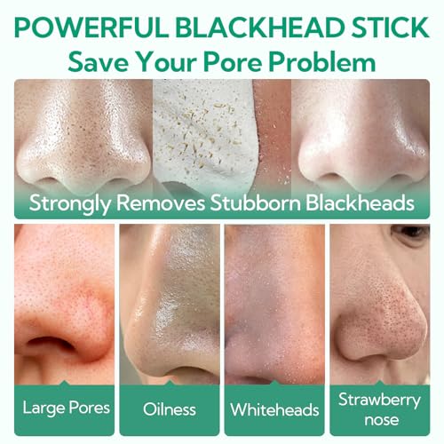 BREYLEE Blackhead Remover Mask, Tea Tree Oil Nose Pore Strips +100 papers, Puntos Negros, Peel Off Mask for Nose and Face, Pore Cleanser Purifying, Brush Desigh - Image 3
