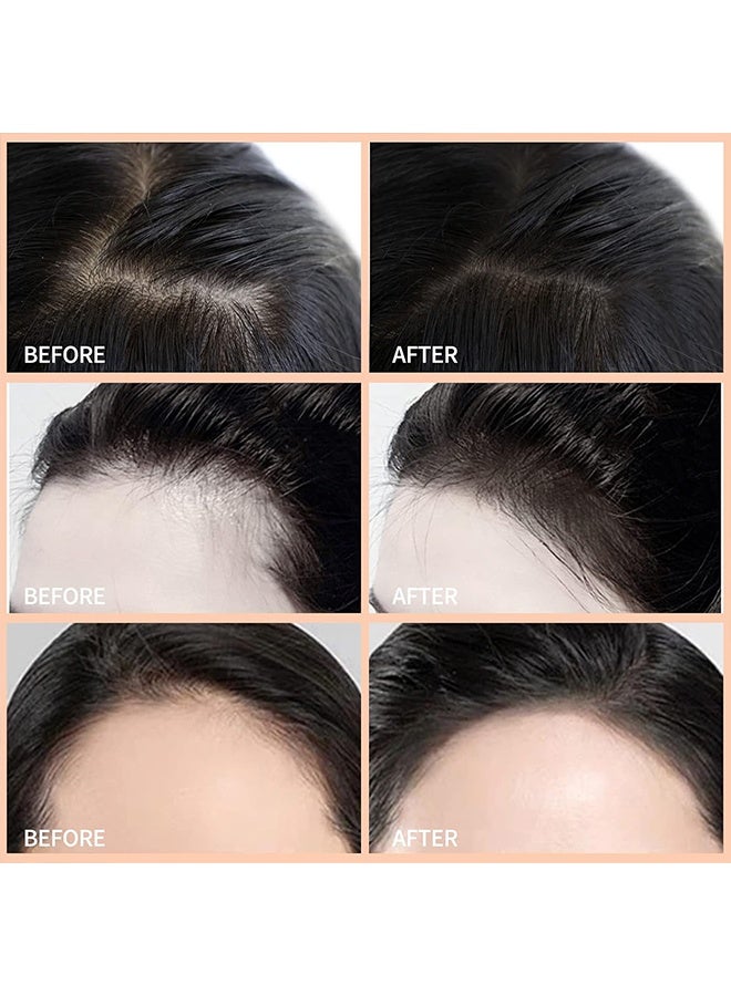 East Moon Hair Concealer,Hairfillup Hair Concealer for Men,Root Cover Up,Concealer for Hair,Hair Fillup Hair Concealer,Hair Fibers for Men,Easily Cover Loose Hair and Show Hair Volume 50g - Image 5