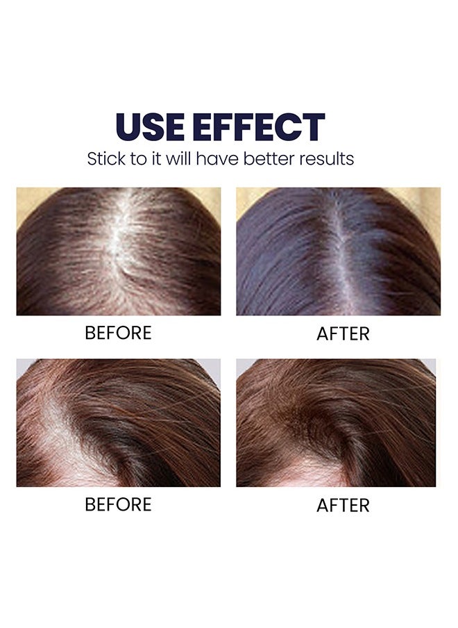 OUHOE - Hair Growth Spray - Hair Growth Serum Spray, Ultra Hair Growth Formula Serum Spray, Grow Thicker Hair In 8 Weeks - Image 1
