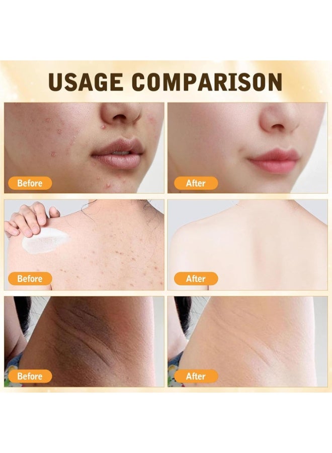 ساوث مون كريم سم النحل الشامل。 مرهم سم النحل ، كريم سم النحل ، كريم إصلاح سم النحل كريم كامل للعناية بالبشرة ، كريم مرهم سم النحل الاحترافي لجميع أنواع البشرة 60 جرام - Image 4