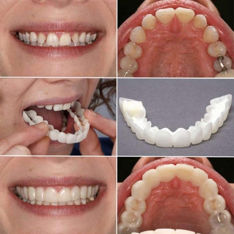 BIRZAR برازار سناب أون ابتسامة مثالية فورية طقم أسنان مريح يناسب الأسنان العلوية والسفلية غطاء تجميلي للأسنان البيضاء. (عبوة من 2) - Image 4