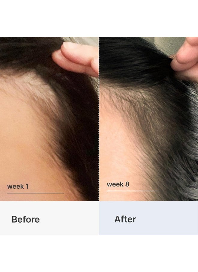 Better Not Younger Better Not Younger Fortifying Serum for Thinning and Aging Hair - Promoting Stronger, Thicker Looking Hair Density for Women 40+ Experiencing Hair Loss - 2fl.oz  - Image 3