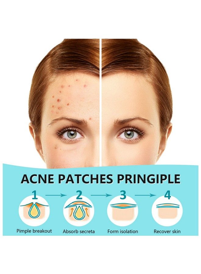 PICcircuit 180 Counts Hydrocolloid Patches For Face Invisible Zit Pimple Acne Spot Treatment Blemish Patch Cover Stickers  - Image 3