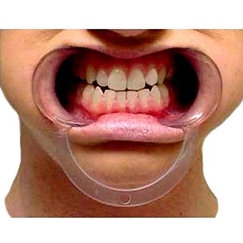 JOBEBE 15 pcs Speak Out Dental Cheek Retractor Watch Ya Mouth Game C Adult Kids Teeth Whitening Mouth Opener S M L Blue Clear -Large - Image 2