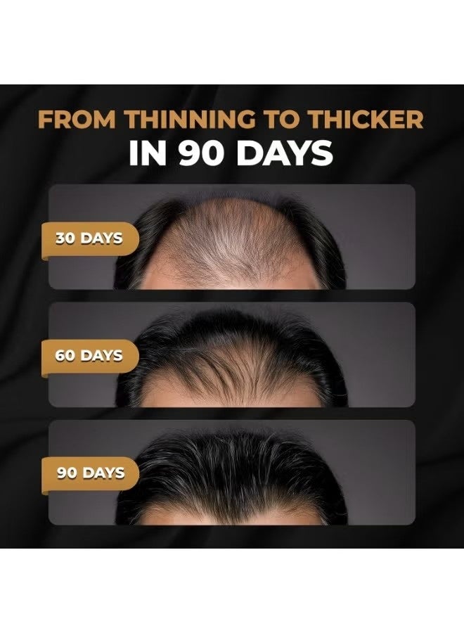 سبارتان شامبو تنشيط الجذر للرجال - شامبو نمو الشعر لتساقط الشعر ورقق الشعر - Image 5