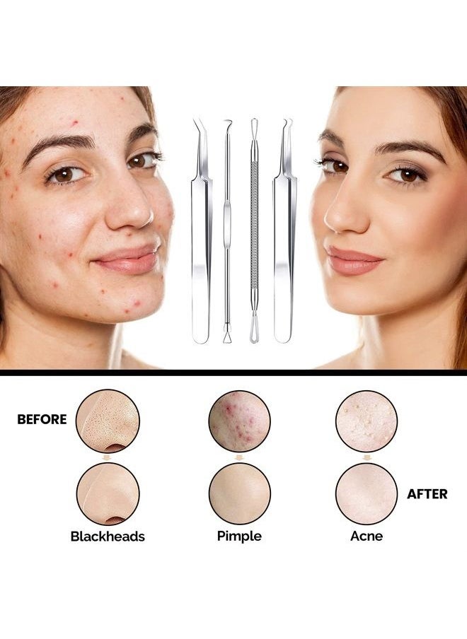 Dermated [16 Pack] Blackhead Remover Tools Pimple Popper Tool Kit | Stainless Steel Professional Pimple Extractor Tool Kit for Blackheads, Blemish, Comdone, Acne, Zit, and Whiteheads for Face & Nose