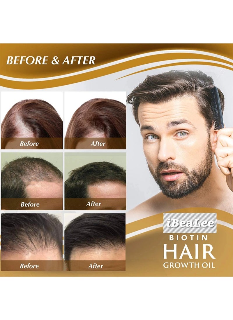 iBealee - Hair Growth Serum - Biotin Serum for Hair Regrowth Prevents Hair Loss and Natural Serum for Thicker, Stronger, Longer Hair for Men and Women-20ml - Image 1
