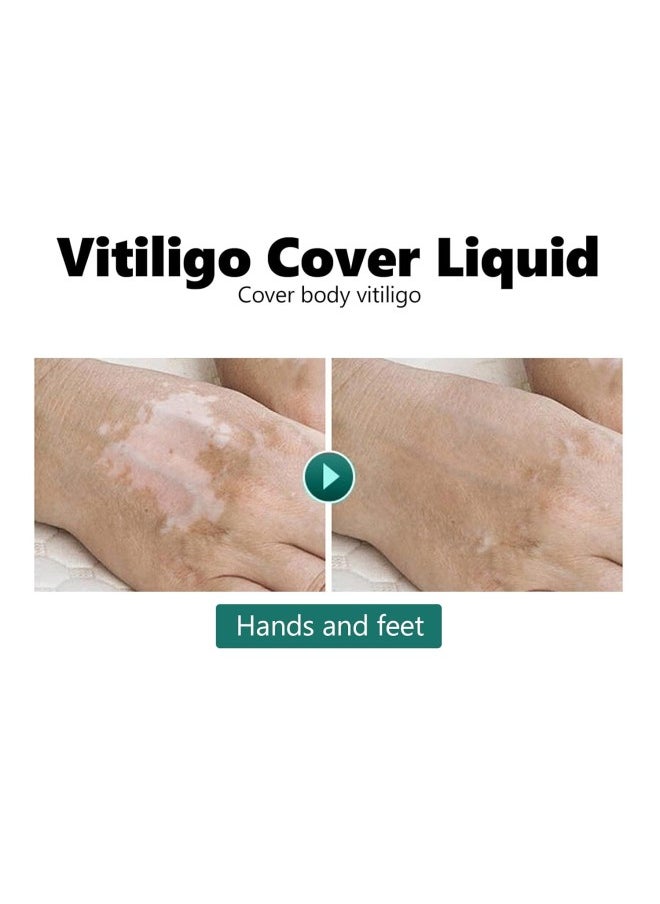 klarako - 20ml Vitiligo Covering Liquid, White spot concealer, Waterproof Makeup Vitiligo Concealer Cosmetics for Face Body, skin tone concealer - Image 1
