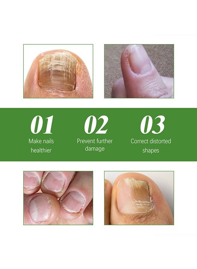 SOUTH MOON Nail Roller Serum - Nail Strengthener - Cuticle Oil for Nails - Roll-On Nail Care - Roller Massage Serum - Repair & Renew Nails - Keep Nails Healthy 10ML - Image 4