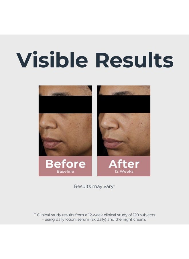 Eucerin Radiant Tone Night Cream, Dark Spot Corrector with Thiamidol, Night Moisturizer for Face Helps Visibly Reduce the Look of Persistent Dark Spots, All Skin Types, 1.7 Oz Bottle - Image 4