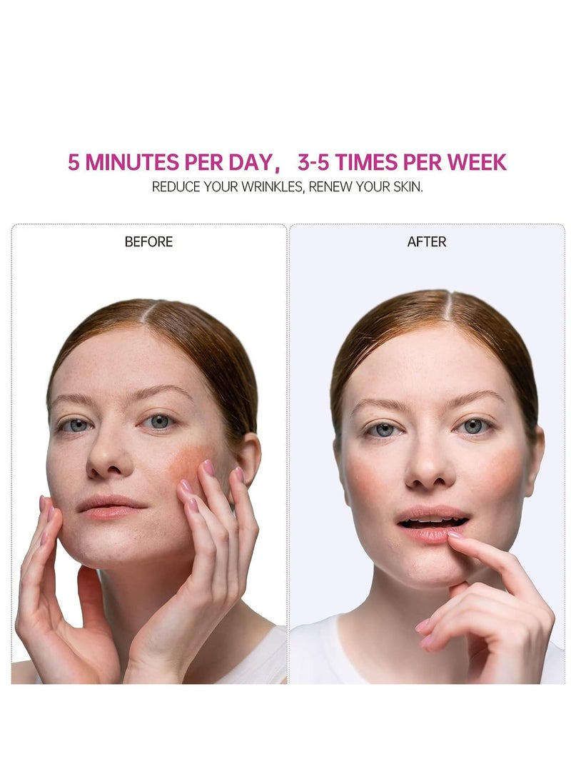 4-in-1 Face Skin Tightening Machine with Red Light Therapy  Massager - Anti-Aging Tool for Wrinkle Reduction, Upgraded 2022 Version in Dark Grey/Fuchsia - Image 3