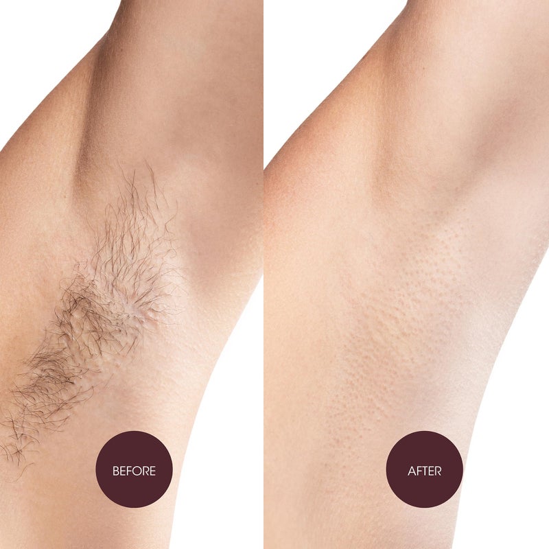 Nad's Nadâ€™s Body Wax Strips for Sensitive Skin, Hair Removal for Sensitive Skin, Hypoallergenic, Includes 28 Waxing Strips & 2 Post Wax Calming Oil Wipes - Image 5