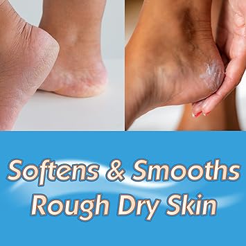 Masterplast Heel Balm Soften For Relief Comfort Ready To Use 70G - Image 3